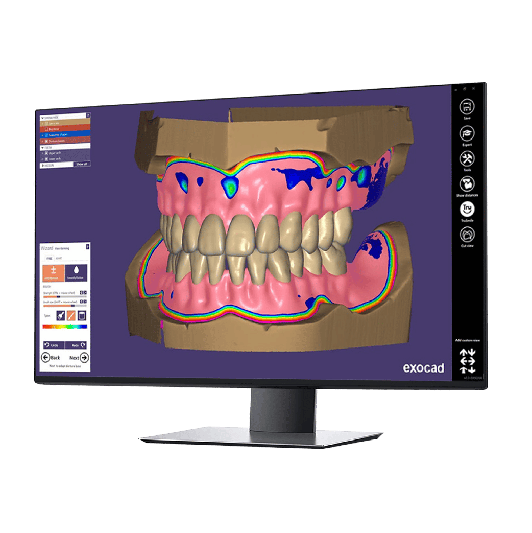 exocad softver prikazan na monitoru